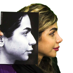 عمل بینی، دکتر خداکرمی، کلینیک ملورین