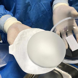 پروتز سینه، عمل پروتز سینه، هزینه عمل پروتز سینه